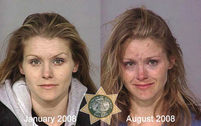 Shocking Pictures Show Consequences of Drug Use